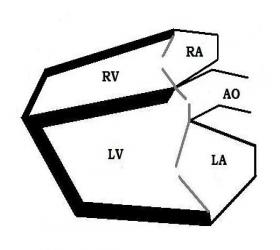 ResizedImage280250 Hart normaal echo