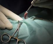 Chirurgie